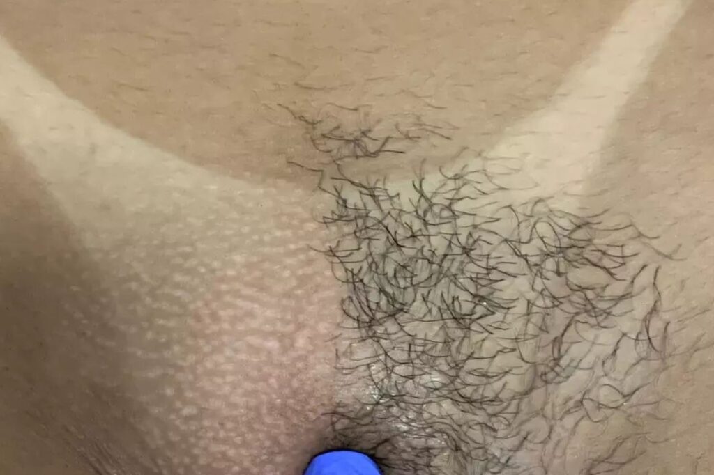 1000151161